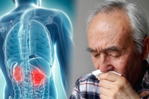 Bác sĩ khuyến cáo 5 điều cần làm để tránh xa căn bệnh ung thư thận