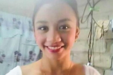 Cô gái xinh đẹp bị biến dạng khuôn mặt và mất thị lực sau một lần nặn mụn