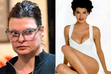 Linda Evangelista tái xuất quyến rũ sau ca phẫu thuật thẩm mỹ hỏng