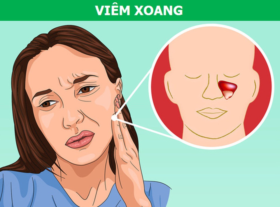 Những cơn đau kỳ lạ xuất phát từ răng miệng nói lên điều gì về sức khỏe? - 1 Những cơn đau kỳ lạ xuất phát từ răng miệng nói lên điều gì về sức khỏe? - 1
