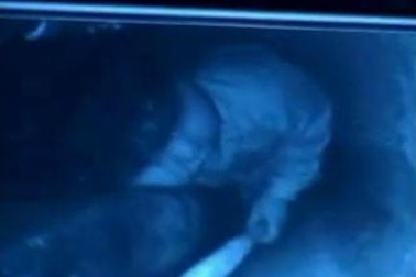 Argentina giải cứu ngoạn mục bé gái rơi xuống giếng sâu 30m