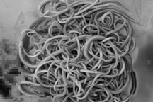 Bé 2 tuổi sốc nặng, bác sĩ gắp ra hơn 100 con giun đũa đóng búi trong ruột