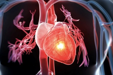 Căn bệnh hiểm ở tim, trẻ mắc phải dễ tử vong trước tuổi trưởng thành