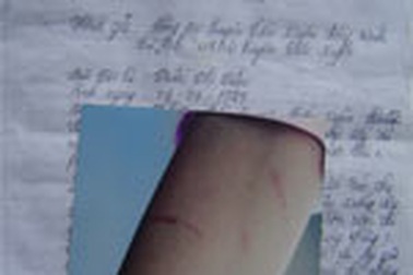 Một Trưởng công an xã bị tố cáo hành hung người