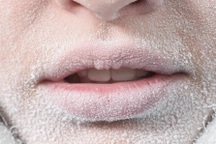 Bí ẩn hiện tượng người bị "đóng băng" vẫn sống sót thần kỳ