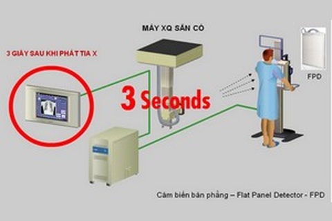 Giải pháp số giúp nâng cao chất lượng chẩn đoán hình ảnh X-Quang