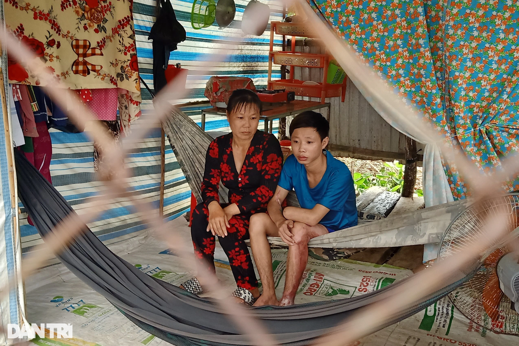 Bị tai nạn, chàng trai hiếu thảo mong có tiền lắp tay giả, phụ mẹ nuôi em - 7 Bị tai nạn, chàng trai hiếu thảo mong có tiền lắp tay giả, phụ mẹ nuôi em - 7