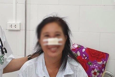 Bệnh nhân bị vi khuẩn Whitmore "ăn" mòn mũi điều trị  liên tục hơn 20 ngày