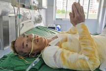 Người bố trẻ dân tộc Mông bỏng 64% cơ thể chắp tay khẩn cầu: “Xin cứu em!”