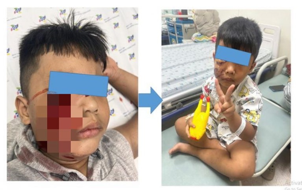 TPHCM: “Khối nghỉ hè” liên tục đi cấp cứu vì bị động vật tấn công