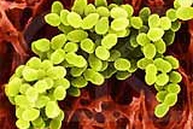 Ngộ độc hàng loạt từ một vết đứt tay