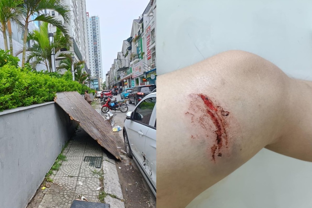 Thót tim người đàn ông bị miếng gỗ bay trúng người trong cơn dông ở Hà Nội - 1 Thót tim người đàn ông bị miếng gỗ bay trúng người trong cơn dông ở Hà Nội - 1