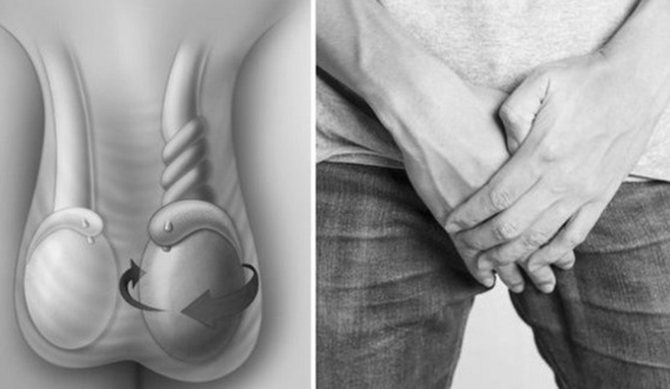 Nam giới ám ảnh xoắn tinh hoàn - chậm là mất đạn - 1 Nam giới ám ảnh xoắn tinh hoàn - chậm là mất đạn - 1