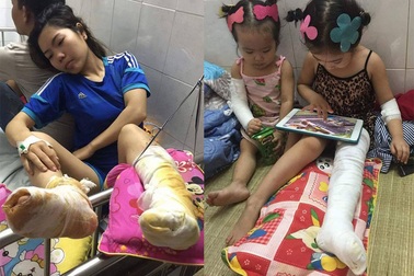Vụ đốt rác khiến 3 cô cháu bỏng nặng: Sở Y tế tỉnh vào cuộc