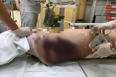 Tố cáo bạo hành trẻ em: "Pháp luật của lương tâm" và phẩm giá của người lớn