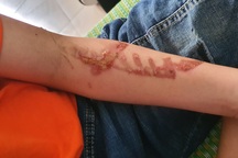 Khởi tố chủ quán bánh xèo hành hạ nhân viên