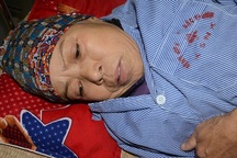 Mong manh tính mạng người phụ nữ dân tộc Nùng mắc cùng lúc nhiều thứ bệnh