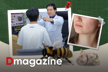 Bác sĩ giật mình vì người Việt cho ong đốt chân, đắp tỏi lên mặt chữa bệnh