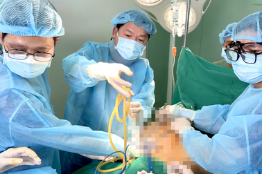 Hút 5 lít dịch và chất lạ từ ngực người phụ nữ sau tiêm mỡ nhân tạo 20 năm