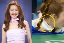 Thúy Ngân bị thương ở cổ, phải tạm dừng hoạt động: Tình hình hiện ra sao?