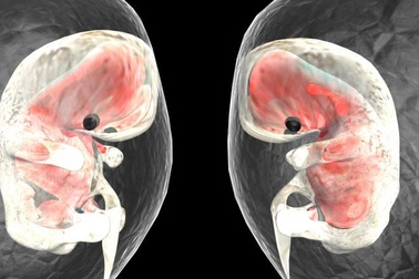 Thai trong thai – hiện tượng kỳ lạ và hiếm gặp