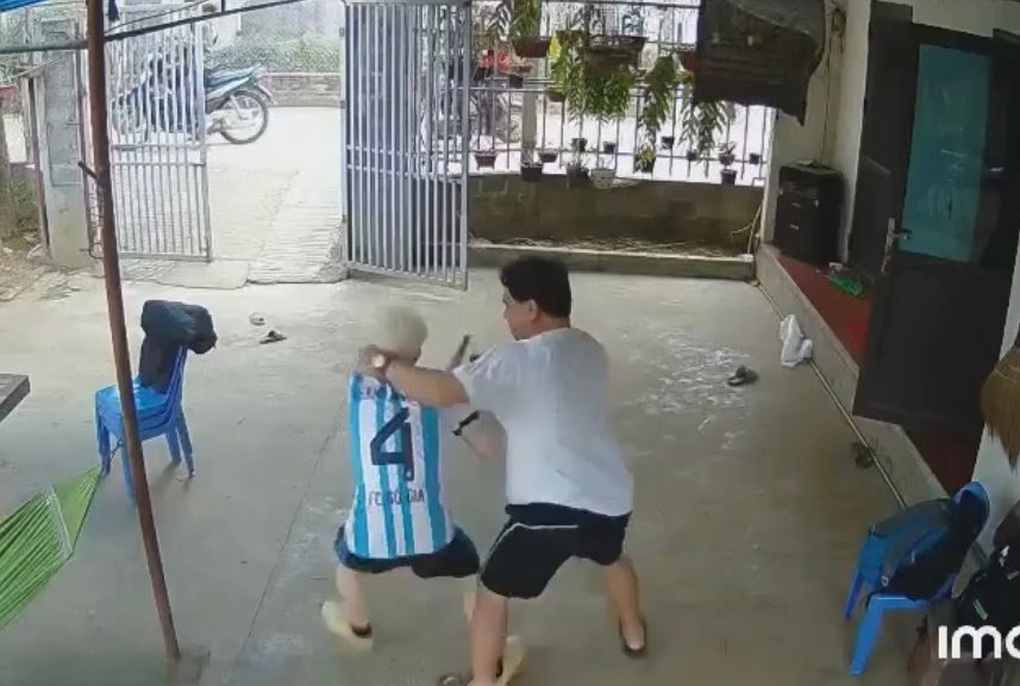 Cậu bé bạch tạng bị ông nội của bạn hành hung - 1 Cậu bé bạch tạng bị ông nội của bạn hành hung - 1