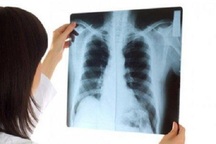 Người phụ nữ ung thư phổi di căn dù chỉ có dấu hiệu khó thở, tức ngực