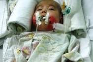 Bé Nhân Ái đã giảm được 30% virus nhiễm trùng máu