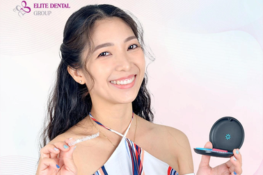 Hô răng cửa nhẹ nên niềng răng hay bọc sứ?