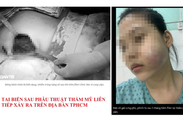 Trường dạy nghề làm đẹp "mang tiếng oan" sau nhiều vụ tai biến thẩm mỹ