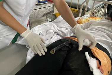 Bị tai nạn giao thông, cô gái trẻ mang cả chân chống xe vào bệnh viện