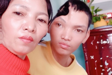 Được bạn đọc giúp đỡ, người mẹ bán rau vui mừng chờ ngày ghép sọ cho con