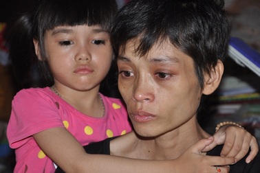 Tấn bi kịch của người đàn bà chỉ nặng... 20kg