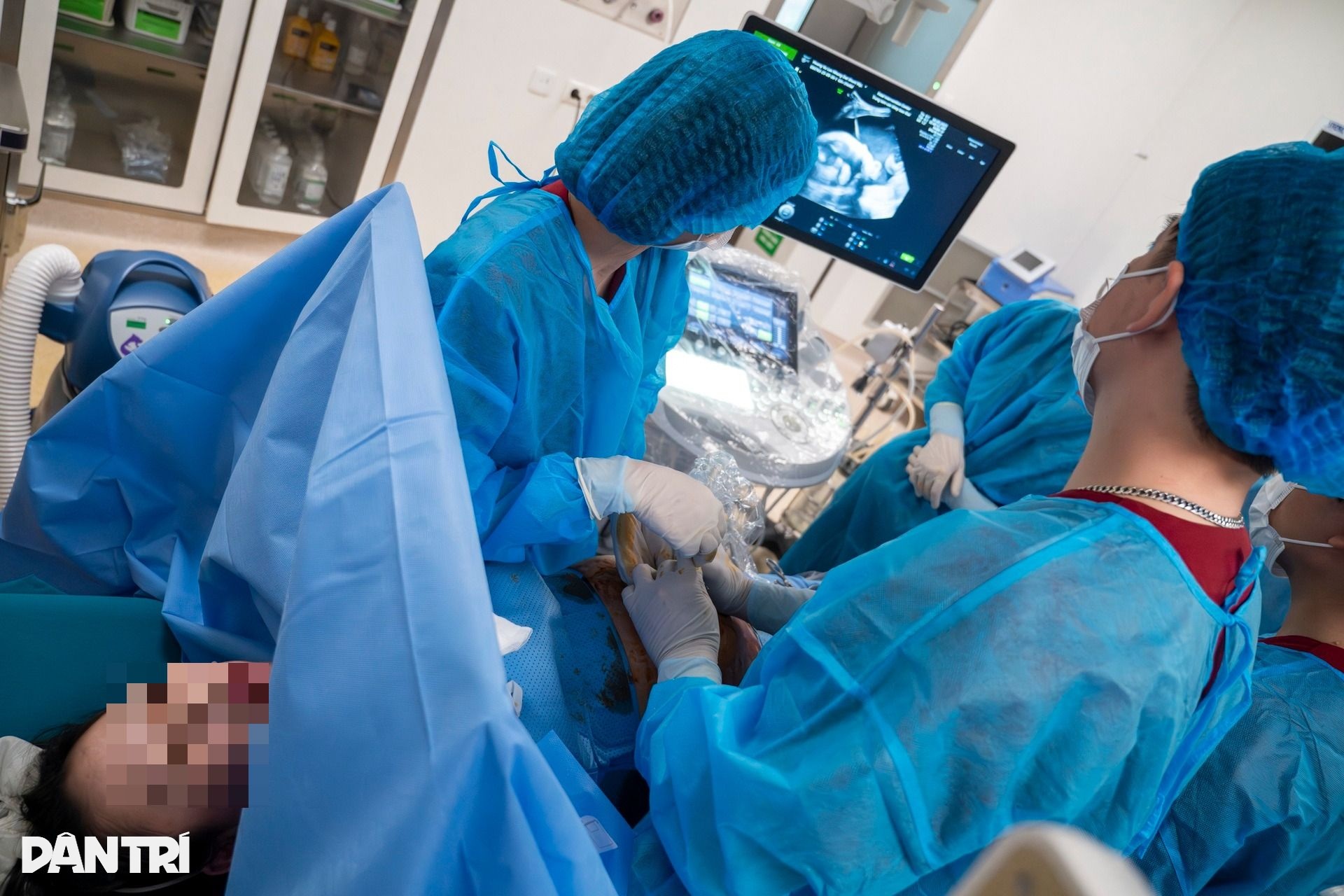 Doktor menggunakan jarum sebagai benang untuk menyelamatkan Bác sĩ dùng kim như sợi chỉ cứu “thiên thần” tràn dịch phổi trong bụng mẹ - 11