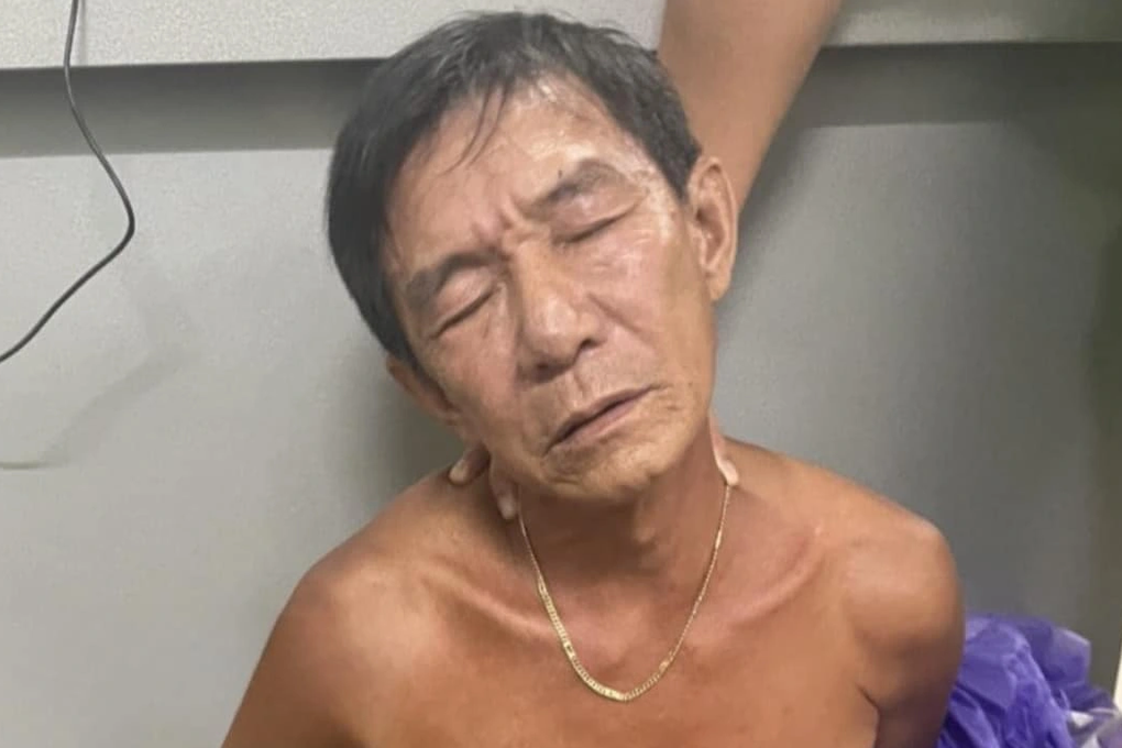 Đang nhậu rồi xin về trước, người đàn ông bị bạn đâm nguy kịch - 1 Đang nhậu rồi xin về trước, người đàn ông bị bạn đâm nguy kịch - 1