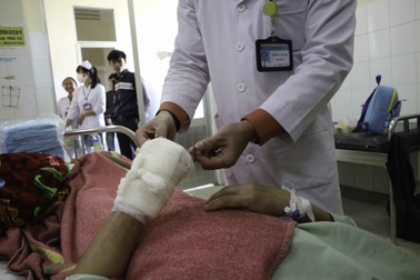 Nối thành công bàn tay bị chém đứt lìa