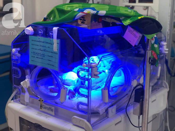 Mẹ trẻ An Giang nghẹn ngào vì con gái đầu lòng vừa mới sinh đã không có hậu môn - Ảnh 4. Mẹ trẻ An Giang nghẹn ngào vì con gái đầu lòng vừa mới sinh đã không có hậu môn - Ảnh 4.