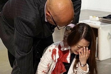 Kinh hoàng tội ác bị tưởng nhầm là… sắp đặt nghệ thuật