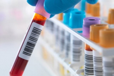 Ca nhiễm HIV được chữa khỏi thứ 3 trên thế giới