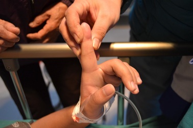 Hy hữu ca sốc phản vệ do kiến cắn ngón tay