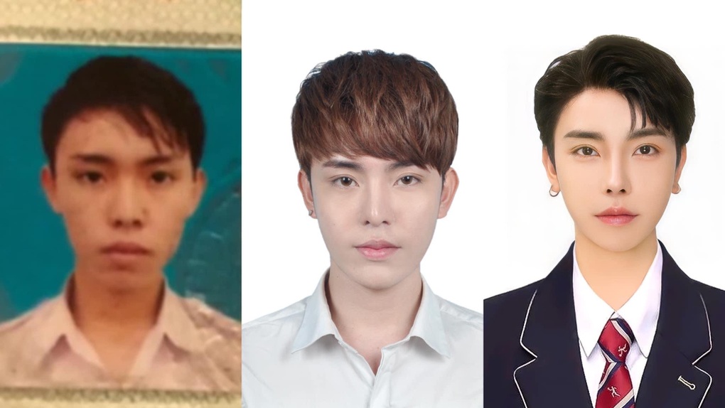 9X Việt chi hàng tỷ đồng, phẫu thuật 11 lần để sở hữu ngoại hình trong mơ - 1 9X Việt chi hàng tỷ đồng, phẫu thuật 11 lần để sở hữu ngoại hình trong mơ - 1