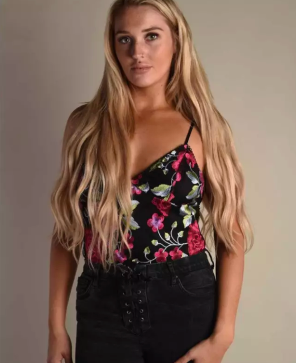 Chi hơn 1 tỷ đồng phẫu thuật thẩm mỹ, vẫn xin tiền để làm tiếp - 3 Chi hơn 1 tỷ đồng phẫu thuật thẩm mỹ, vẫn xin tiền để làm tiếp - 3