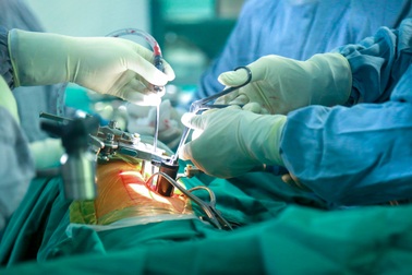 Phẫu thuật cột sống không còn lo "đụng chạm" dây thần kinh