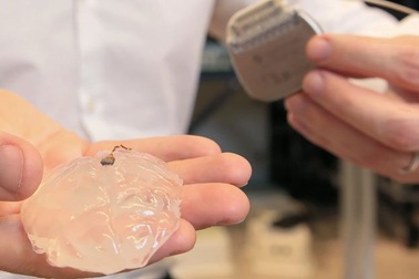 Mô cấy não không dây lần đầu tiên khôi phục khả năng đi lại