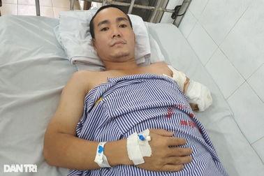 Ông bố trẻ hét lên đầy tuyệt vọng vì bỏng điện phải cắt cụt tay