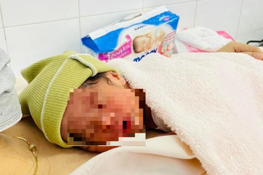 "Mẹ tròn 3 con vuông" sau ca phẫu thuật cho sản phụ bị tiền sản giật