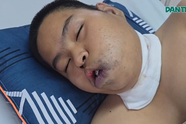 Cậu bé bệnh hiểm, ngủ ngồi từ lúc 5 tuổi mong được cứu