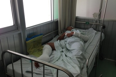 Truy bắt hung thủ vô cớ chém 2 nạn nhân trọng thương