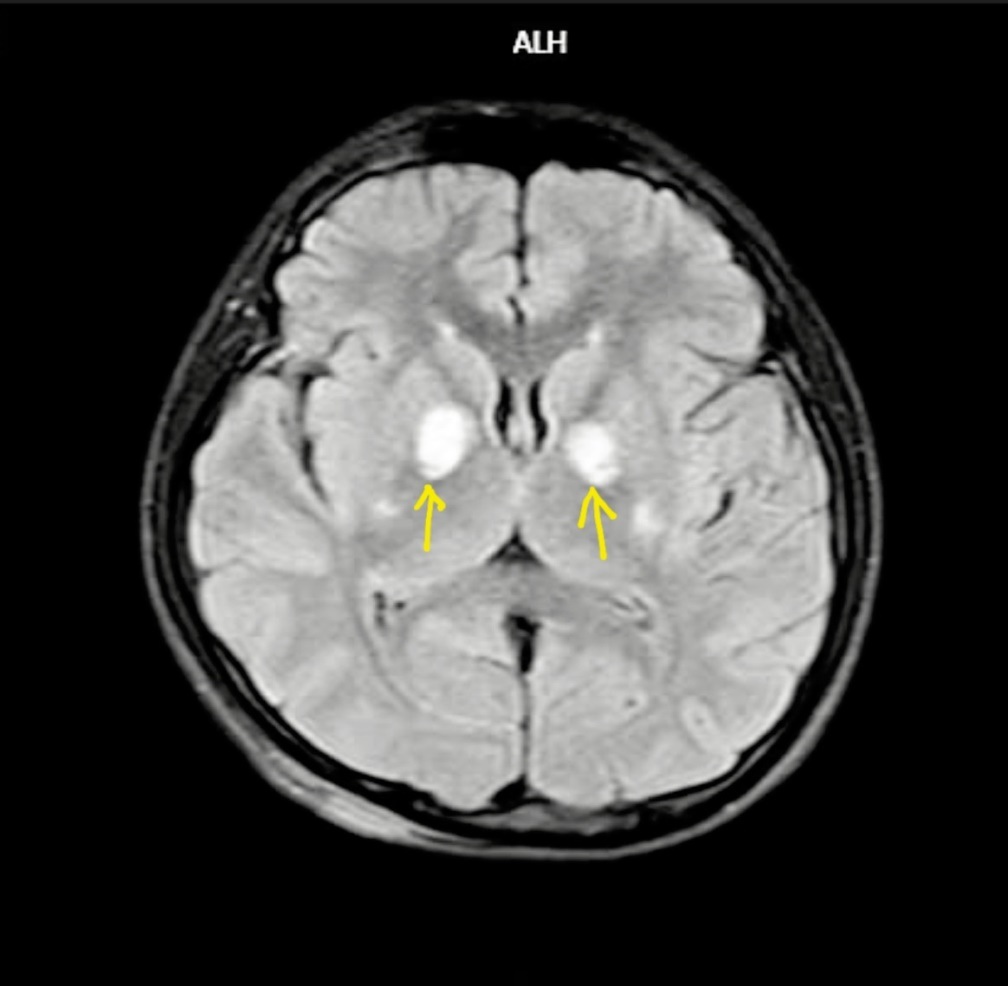 Hà Nội: 6 người làm việc trong bếp ăn nhà hàng, 3 người ngộ độc - 2