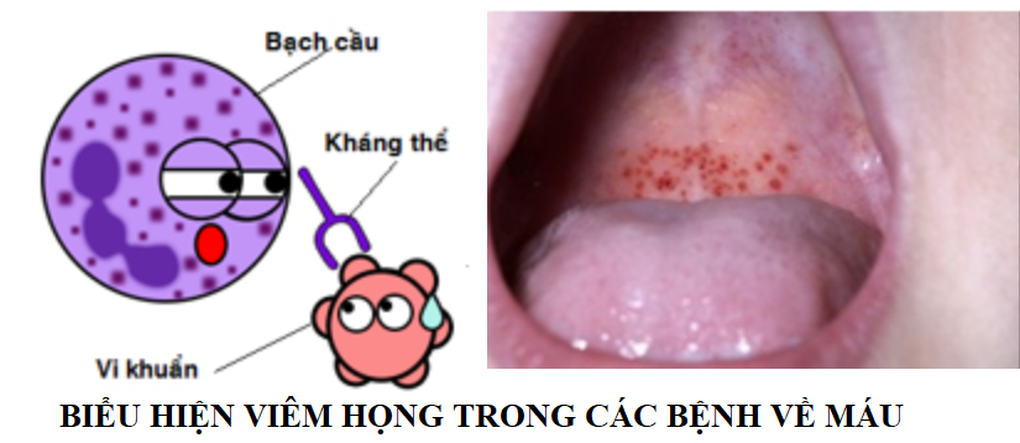Chàng trai phát hiện ung thư nhờ dấu hiệu tưởng bệnh vặt này - 1 Chàng trai phát hiện ung thư nhờ dấu hiệu tưởng bệnh vặt này - 1